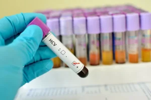 HCV检测欧洲市场分析与法规准入要求解析